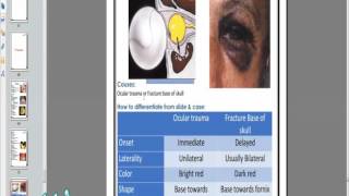 Practical Ophthalmology  Trauma Tumors and Uvea [upl. by Thisbe413]