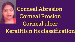 Classification of keratitiswhat is corneal abrasioncorneal erosionkeratitis and corneal ulcer [upl. by Ormond]