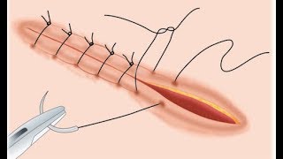 Suturing Techniques in Surgery Basic surgical Skill [upl. by Bazil]