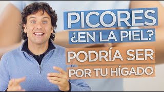 ¿PICORES POR EL CUERPO La causa podría estar en tu hígado [upl. by Ecnarepmet]