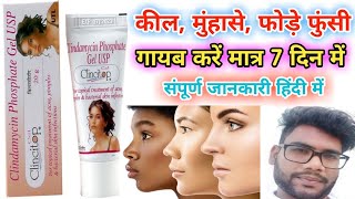 Clincitop gel uses and side effects  कील मुंहासे फोड़े फुन्शी की सबसे अच्छी क्रीम  Hindi review [upl. by Rifkin209]