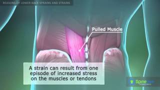 Lower Back Sprain and Strain Reasons [upl. by Adelind]