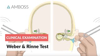 Weber and Rinne Test  Clinical Examination [upl. by Nassir861]