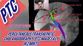 PTCpercutaneous Transhepatic Cholangiography Made Easy [upl. by Akcirehs]