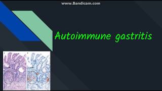 Autoimmune gastritis [upl. by Lewis]