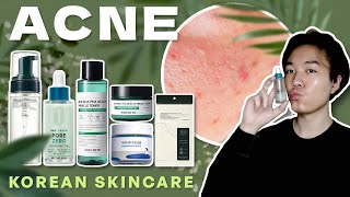 ACNE Treatment  6 Korean Skincare for Oily amp Acne Prone Skin 💦 🇰🇷 [upl. by Neelram421]