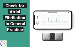 Easy way to check for atrial fibrillation in General Practice  with Alivekor Kardia [upl. by Britta]