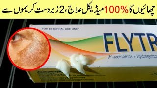 Remove Freckles amp Melasma on Face with Hyderquin Plus amp Flytro Cream Urdu Hindi [upl. by Aihsem]