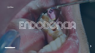 ENDODONCIA  DENTAL CALIFORNIA [upl. by Aimas]