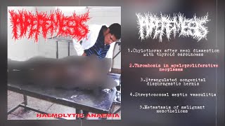 Hyperemesis  Haemolytic Anaemia Split with PxCxSx 2013 Goregrind [upl. by Adnuahs]