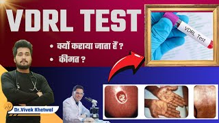 VDRL Test l VDRL Test In Hindi l Dr Vivek Khetwal vdrl youtube [upl. by Dorsman]