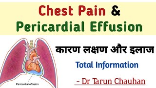 Pericardial Effusion in hindi  chest pain and pericardial effusion  seene me dard [upl. by Marra]