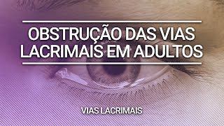 Obstrução das Vias Lacrimais em Adultos  Clínica Dr André Borba [upl. by Askari895]