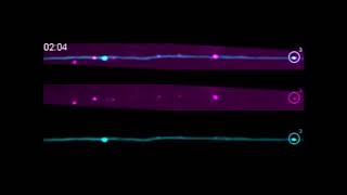 Multivesicular bodies mediate longrange retrograde NGFTrkA signaling [upl. by Jewelle]