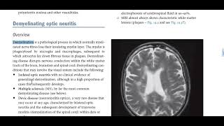 Kanski Clinical Ophthalmology made easy  neuro ophthalmology 4 [upl. by Odnomar323]