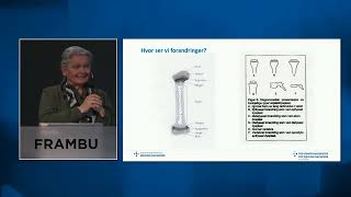 Medisinsk informasjon om sjeldne beinsykdommer [upl. by Latta]