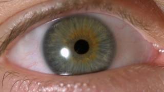 My Iris Wobbles  Eye In Slow Motion [upl. by Brote]