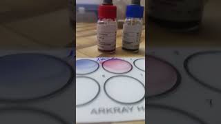 Widal Test 🩸 sorts shorts shortvideo science pathology lab lablife medicallab viralvideo [upl. by Angeline490]