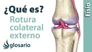 ROTURA DEL LIGAMENTO COLATERAL EXTERNO DE LA RODILLA  ¿Qué es [upl. by Elvie166]