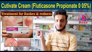 Cutivate Cream Fluticasone Propionate 0 05  Uses Side Effects Application  O Beauty Dose [upl. by Wiles]