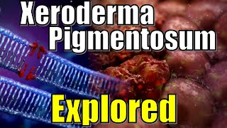 quot Vampire Syndrome quot Xeroderma Pigmentosum DNA Damaged Explained  Effects of UV Radiation on Genes [upl. by Almeida]