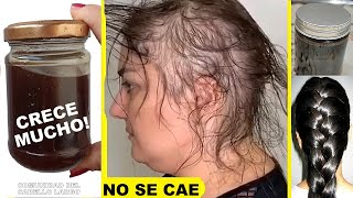 EL CABELLO DEJA DE CAERSE Y CRECE MUCHO CON ESTE CHAMPÚ ORGANICO Y NATURAL🌿100 Efectivo [upl. by Pontius]