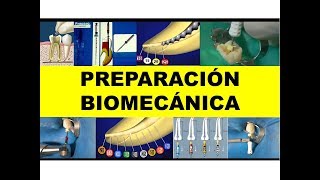 quotPREPARACIÓN BIOMECÁNICAquot por la Dra Carmen Garcia [upl. by Edson]