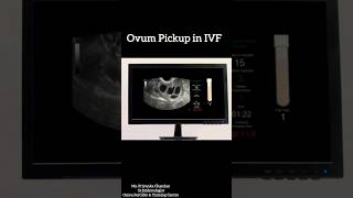 The Incredible Science Behind IVF Egg Retrieval [upl. by Adamsen]