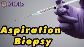 FINE NEEDLE ASPIRATION BIOPSY PROCEDURE [upl. by Anicul]