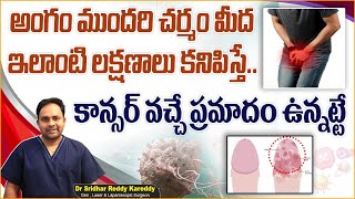 అంగం ముందరి చర్మం మంటగా ఉందా  Balanitis and Balanoposthitis Symptoms in Telugu  TRH [upl. by Anaahs]