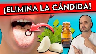 ¡Elimina HONGOS como la CÁNDIDA para SIEMPRE  7 REMEDIOS NATURALES [upl. by Ilyah604]