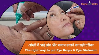 How to put eye drop amp eye ointment after eye surgery  Eye Care Tips [upl. by Doralynn]