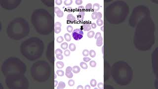 How to tell Anaplasmosis from Ehrlichiosis￼ [upl. by Raama394]