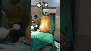 Spinal Anesthesia  How to give Spinal Anesthesia  Dr Aman Siddiqui  anaesthesia  spinal [upl. by Che]