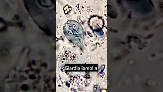 Giardia lambliaGiardiasis parasiteparasite under microscope microscopy parasitology [upl. by Grochow]