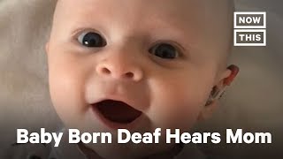 Baby Born Deaf Hears Her Mother for the First Time Shorts [upl. by Yeslrahc225]