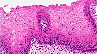 Lab 12  Stratified Epithelium [upl. by Haelak]