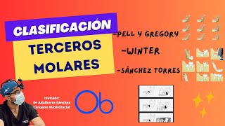 Clasificación de Terceros molares 🦷 Pell y Gregory  Winter  Sánchez Torres [upl. by Llehcear932]