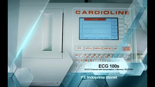 ECG 100s  CARDIOLINE [upl. by Labina]