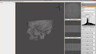 Preparing DICOM images CTMRT for 3d printing STL [upl. by Leyla984]