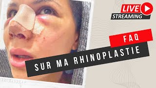 FAQ RHINOPLASTIE EN TURQUIE [upl. by Matrona]