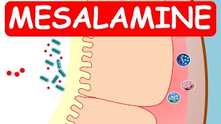 Mesalamine Pentasa ER capsules for ulcerative colitis [upl. by Eiclud]