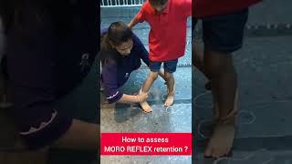 Moro reflex  assessment assess if Moro reflex is retained [upl. by Oiretule]