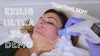 EXILIS ULTRA DEMONSTRATION FACE  Exilis Ultra 360 Experience at EuroPhoria [upl. by Ellinger]