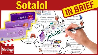 Sotalol 80 mg Betapace What Is Sotalol Used For Uses Dosage and Side Effects of Sotalol [upl. by Matthew827]