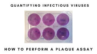 How to Perform a Plaque Assay [upl. by Fredrika597]