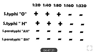 How to Read a Widal Test Report For Typhoid [upl. by Revert255]