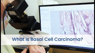 What is Basal Cell Carcinoma [upl. by Leitao]