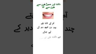 Masoro se khoon aane ka ilaj bleeding gums treatment bleedinggums trending viralvideo shorts [upl. by Lexa]