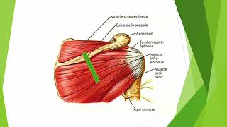 Exploration du tendon infra épineux en échographie [upl. by Nalo]